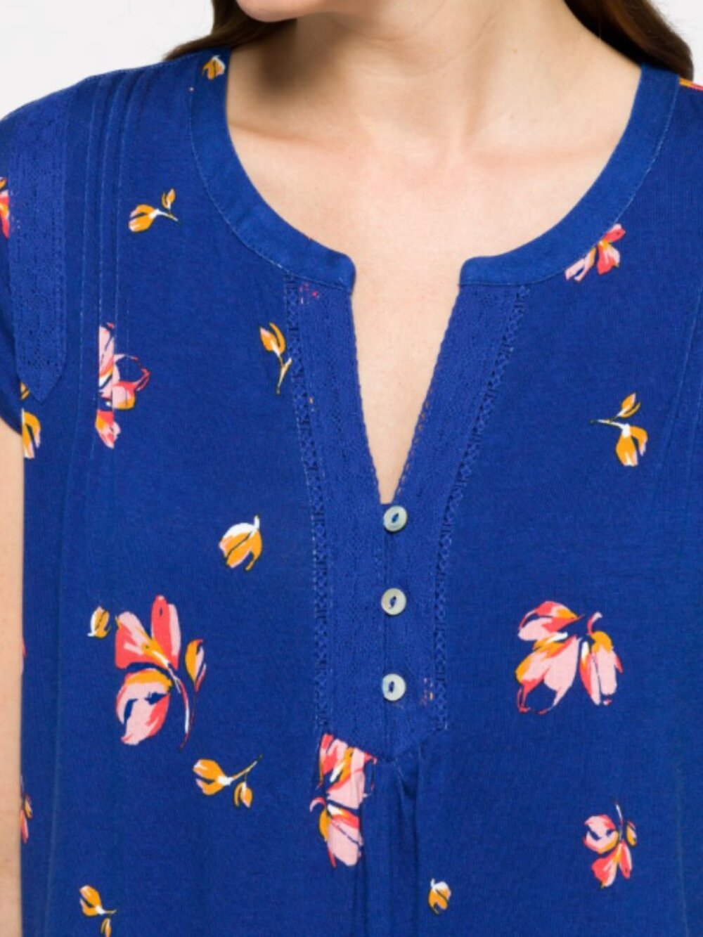 Daniel Rainn Arlie Button Detail Knit Top - Picture 2 of 3